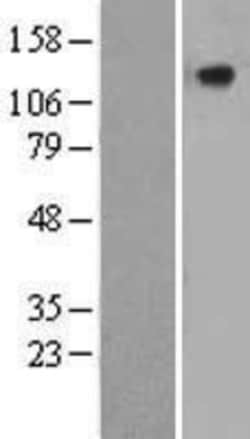 Novus Biologicals&trade;&nbsp;CILP-1 Overexpression Lysate