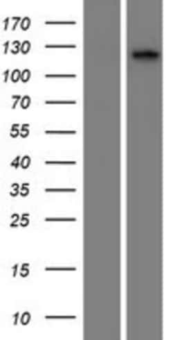 Novus Biologicals&trade;&nbsp;CILP2 Overexpression Lysate