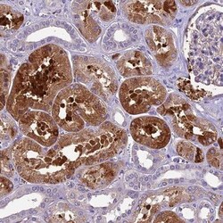 CILP2 Antibody, Novus Biologicals 25 &mu;L, Unlabeled:Antibodies, Polyclonal