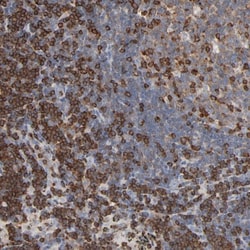 CIN85/SH3KBP1 Antibody, Novus Biologicals:Antibodies:Primary Antibodies