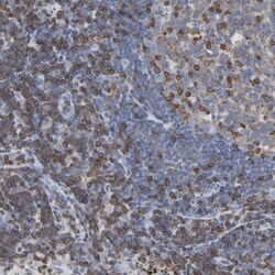 CIN85/SH3KBP1 Antibody, Novus Biologicals:Antibodies:Primary Antibodies