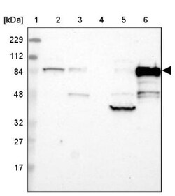 CIN85/SH3KBP1 Antibody, Novus Biologicals:Antibodies:Primary Antibodies