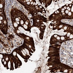 Cingulin Antibody, Novus Biologicals 0.1mL; Unlabeled:Antibodies, Polyclonal