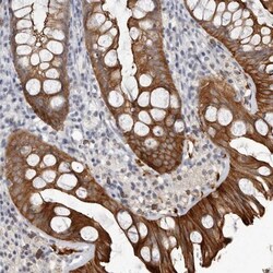 Cingulin Antibody, Novus Biologicals:Antibodies:Primary Antibodies