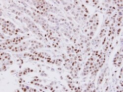 CIP29 Antibody, Novus Biologicals 0.1mL; Unlabeled:Antibodies, Polyclonal
