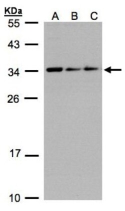 CIP29 Antibody, Novus Biologicals 0.1mL; Unlabeled:Antibodies, Polyclonal