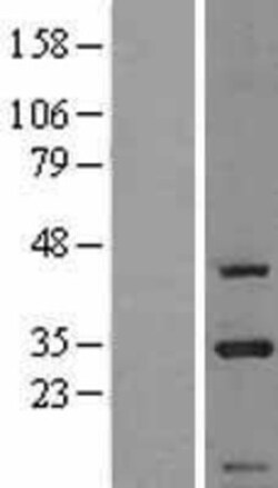 Novus Biologicals&trade;&nbsp;CIP29 Overexpression Lysate
