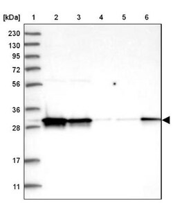 CIP29 Antibody, Novus Biologicals 0.1mL; Unlabeled:Antibodies, Polyclonal