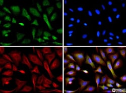 CIP2A Antibody (2G10), Novus Biologicals 0.025mL; Unlabeled:Antibodies,