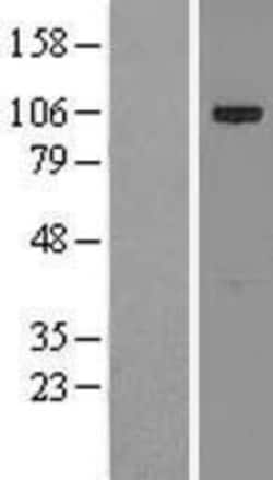 Novus Biologicals&trade;&nbsp;CIP2A Overexpression Lysate
