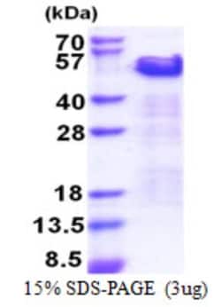 Novus Biologicals&trade;&nbsp;Recombinant Human Cip4 His Protein