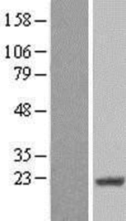 Novus Biologicals&trade;&nbsp;CIRBP Overexpression Lysate