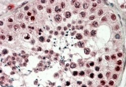 CIRBP Antibody, Novus Biologicals 0.1mg; Unlabeled:Antibodies, Polyclonal