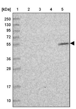 CIRH1A Antibody, Novus Biologicals 0.1mL; Unlabeled:Antibodies, Polyclonal