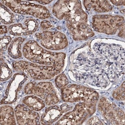 CIRH1A Antibody, Novus Biologicals 0.1mL; Unlabeled:Antibodies, Polyclonal