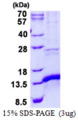 Novus Biologicals&trade;&nbsp;Recombinant Human CISD1 His Protein