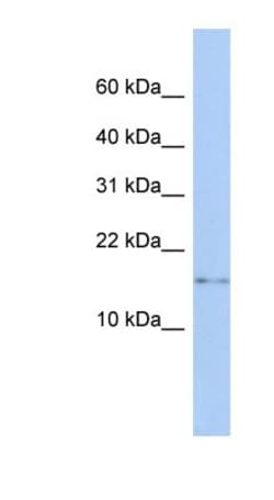 CISD2 Antibody, Novus Biologicals 0.05mg; Unlabeled:Antibodies, Polyclonal