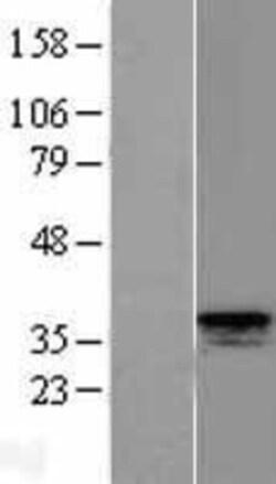 Novus Biologicals&trade;&nbsp;CISH/CIS-1 Overexpression Lysate