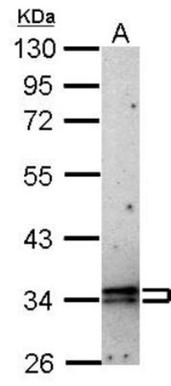 CISH/CIS-1 Antibody, Novus Biologicals 0.1mg; Unlabeled:Antibodies, Polyclonal