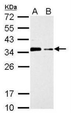 CISH/CIS-1 Antibody, Novus Biologicals 0.1mg; Unlabeled:Antibodies, Polyclonal