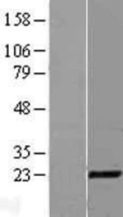 Novus Biologicals&trade;&nbsp;CITED1 Overexpression Lysate