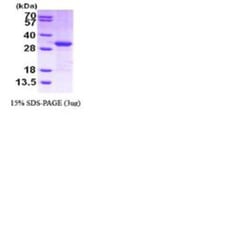 Novus Biologicals&trade;&nbsp;Recombinant Human Cited-2 His Protein