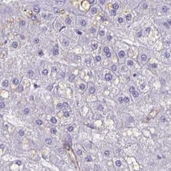 CITED4 Antibody, Novus Biologicals 0.1mL; Unlabeled:Antibodies, Polyclonal