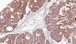 Citidine Deaminase Antibody, Novus Biologicals 0.1mg; Unlabeled:Antibodies,