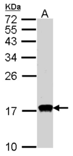 Citidine Deaminase Antibody, Novus Biologicals 0.1mg; Unlabeled:Antibodies,