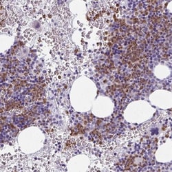 Citidine Deaminase Antibody, Novus Biologicals:Antibodies:Primary Antibodies