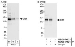 CIZ1 Antibody, Novus Biologicals 0.1mL; Unlabeled:Antibodies, Polyclonal