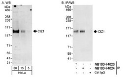 CIZ1 Antibody, Novus Biologicals 100 &mu;L | Buy Online | Novus Biologicals | Fisher Scientific