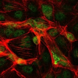 c-jun Antibody (5B1), Novus Biologicals:Antibodies:Primary Antibodies