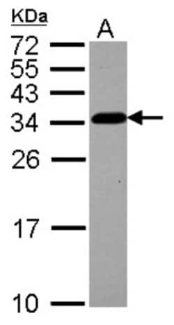 CKAP1 Antibody, Novus Biologicals 0.1mL; Unlabeled:Antibodies, Polyclonal