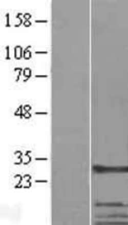 Novus Biologicals&trade;&nbsp;CKAP1 Overexpression Lysate