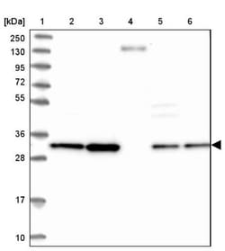 CKAP1 Antibody, Novus Biologicals:Antibodies:Primary Antibodies