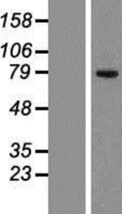 Novus Biologicals&trade;&nbsp;CKAP2 Overexpression Lysate
