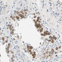 CKAP2 Antibody, Novus Biologicals:Antibodies:Primary Antibodies