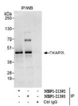 CKAP2L Antibody, Novus Biologicals 0.1mg; Unlabeled:Antibodies, Polyclonal