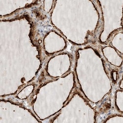 CKI gamma 3 Antibody, Novus Biologicals 25 &mu;L; Unlabeled:Antibodies,