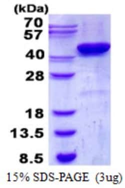 Novus Biologicals&trade;&nbsp;Recombinant Human CKII alpha prime polypeptide His Protein