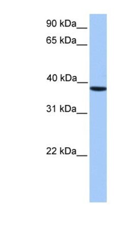 CKII alpha prime polypeptide Antibody, Novus Biologicals 100&mu;L; Unlabeled:Antibodies,