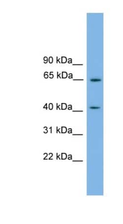 CKIP-1 Antibody, Novus Biologicals:Antibodies:Primary Antibodies