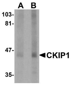 CKIP-1 Antibody - BSA Free, Novus Biologicals:Antibodies:Primary Antibodies
