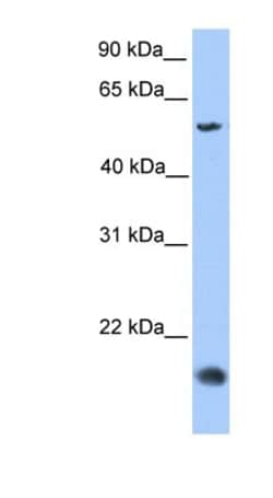 Cklfsf8 Antibody, Novus Biologicals 100&mu;L; Unlabeled:Antibodies, Polyclonal