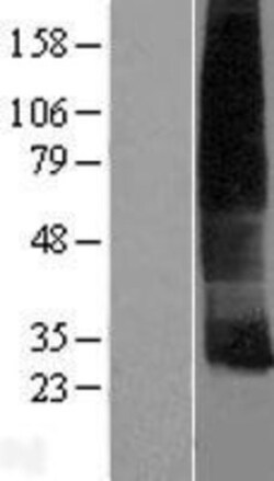 Novus Biologicals&trade;&nbsp;Cklfsf8 Overexpression Lysate