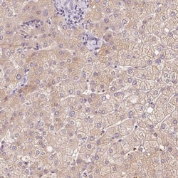 Cklfsf8 Antibody, Novus Biologicals 25 &mu;L | Buy Online | Novus Biologicals | Fisher Scientific