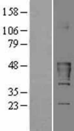 Novus Biologicals&trade;&nbsp;CKMT2 Overexpression Lysate