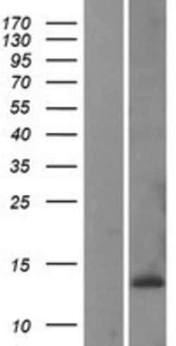 Novus Biologicals™ CKS1 Overexpression Lysate