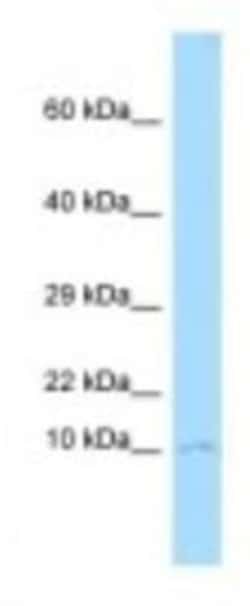 CKS1 Antibody, Novus Biologicals 20&mu;L; Unlabeled:Antibodies, Polyclonal